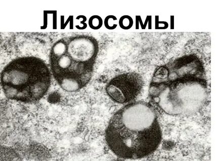Лизосома на микрофотографии