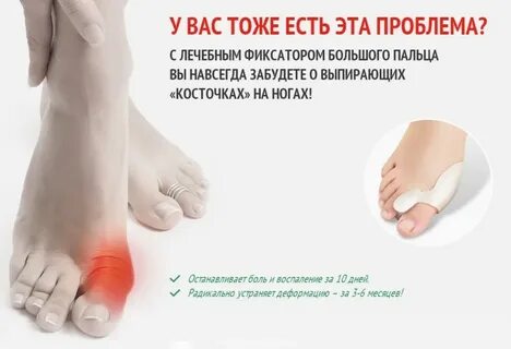 Средства косточки большом пальце