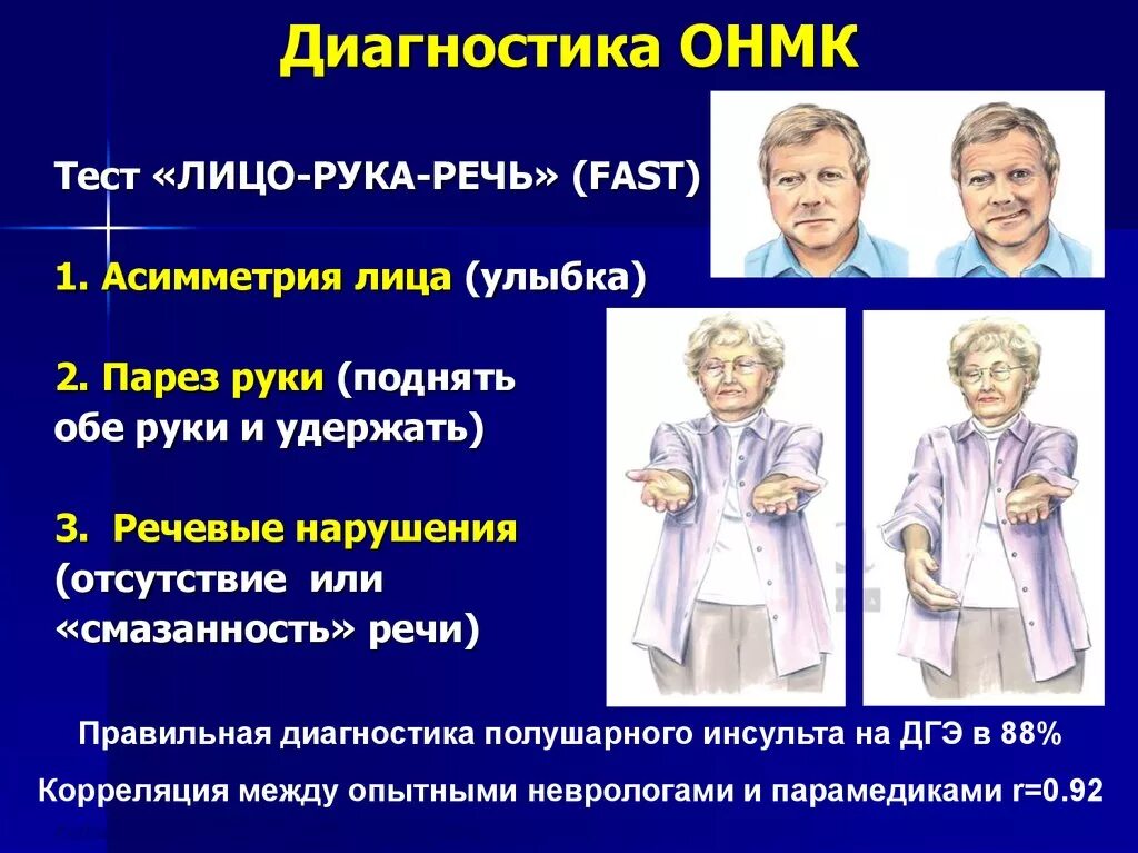 Острое нарушение мозгового кровообращения диагностика. Симптомы ОНМК неврология. Признаки ОНМК. Острым нарушение кровообращение мозга.