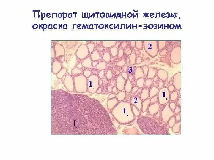 Срез щитовидной железы. Щитовидная железа препарат гематоксилин-эозин гистология. Щитовидная железа окраска гематоксилином и эозином. Препарат – щитовидная железа. Окраска гематоксилин-эозином.. Препарат «щитовидная железа», окраска гематоксилин-эозином, ув. Х100.