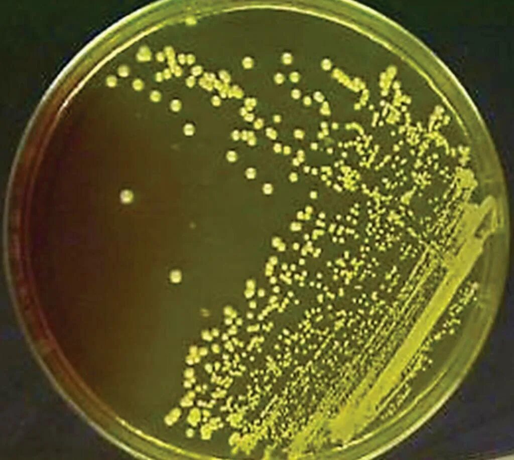 S. aureus золотистый стафилококк. Золотистый стафилококк на ЖСА. Стафилококк ауреус на ЖСА. Желточно солевой агар микробиология. Staphylococcus aureus среда