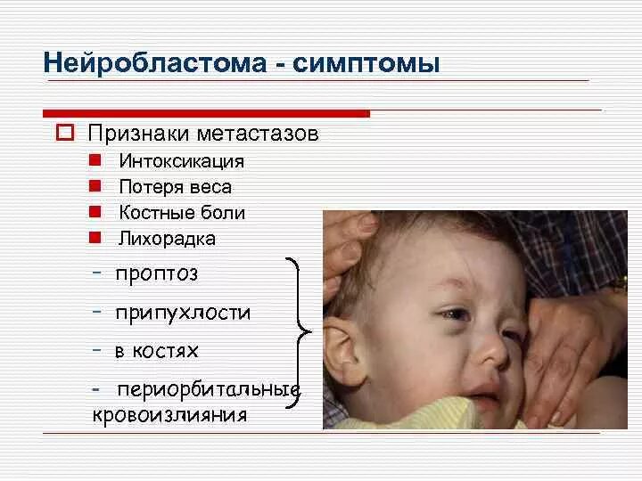 Метастазы у ребенка. Метастазы у ребенка
