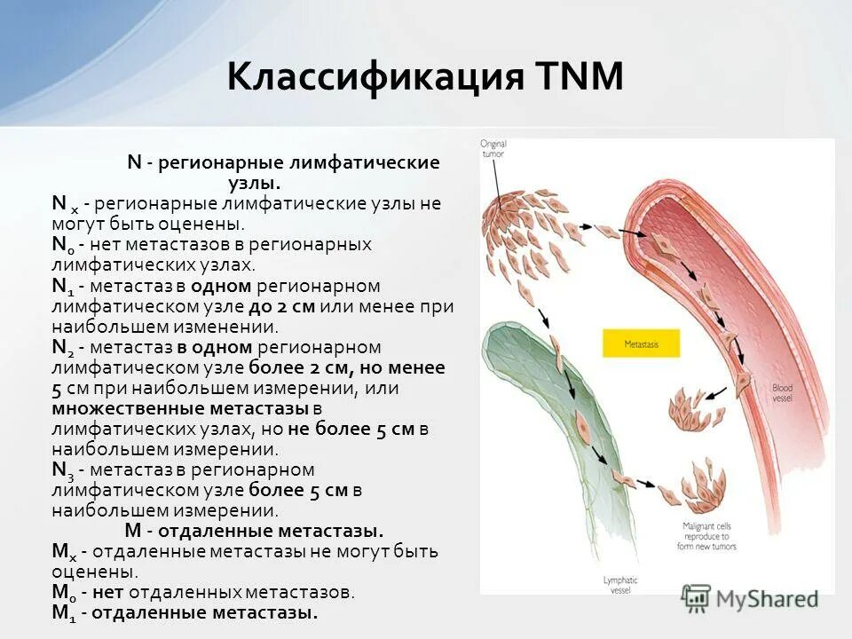 аденолимфома гистология. аденокарцинома печени гистология. метастаз в 1 лимфоузле. метастазы в печени гистология. классификация онкологии.