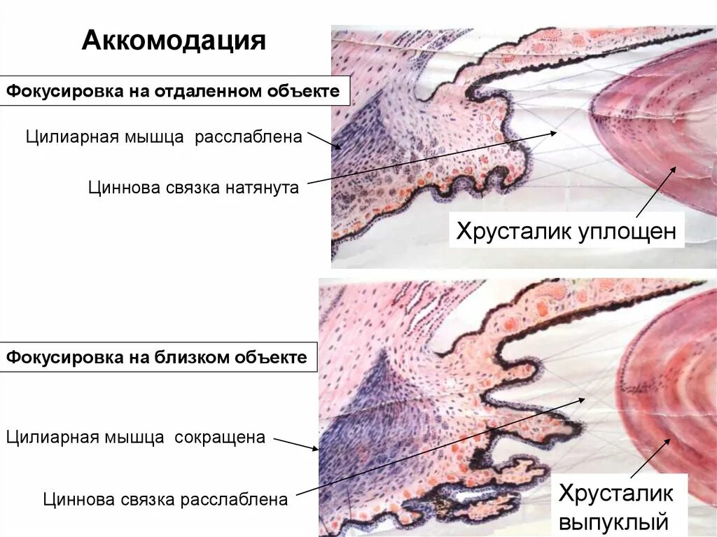 Ресничная мышца глаза функции. Строение цилиарного тела гистология. Цилиарное тело строение гистология. Строение цилиарной мышцы гистология. Мышца Иванова Брюкке Мюллера.