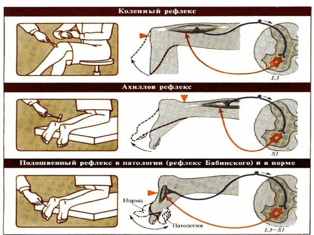 Ахиллов рефлекс рефлекторная. Ахиллов рефлекс физиология схема. Коленный и Ахиллов рефлексы. Коленный Ахиллов и подошвенный рефлексы. Проверка рефлексов