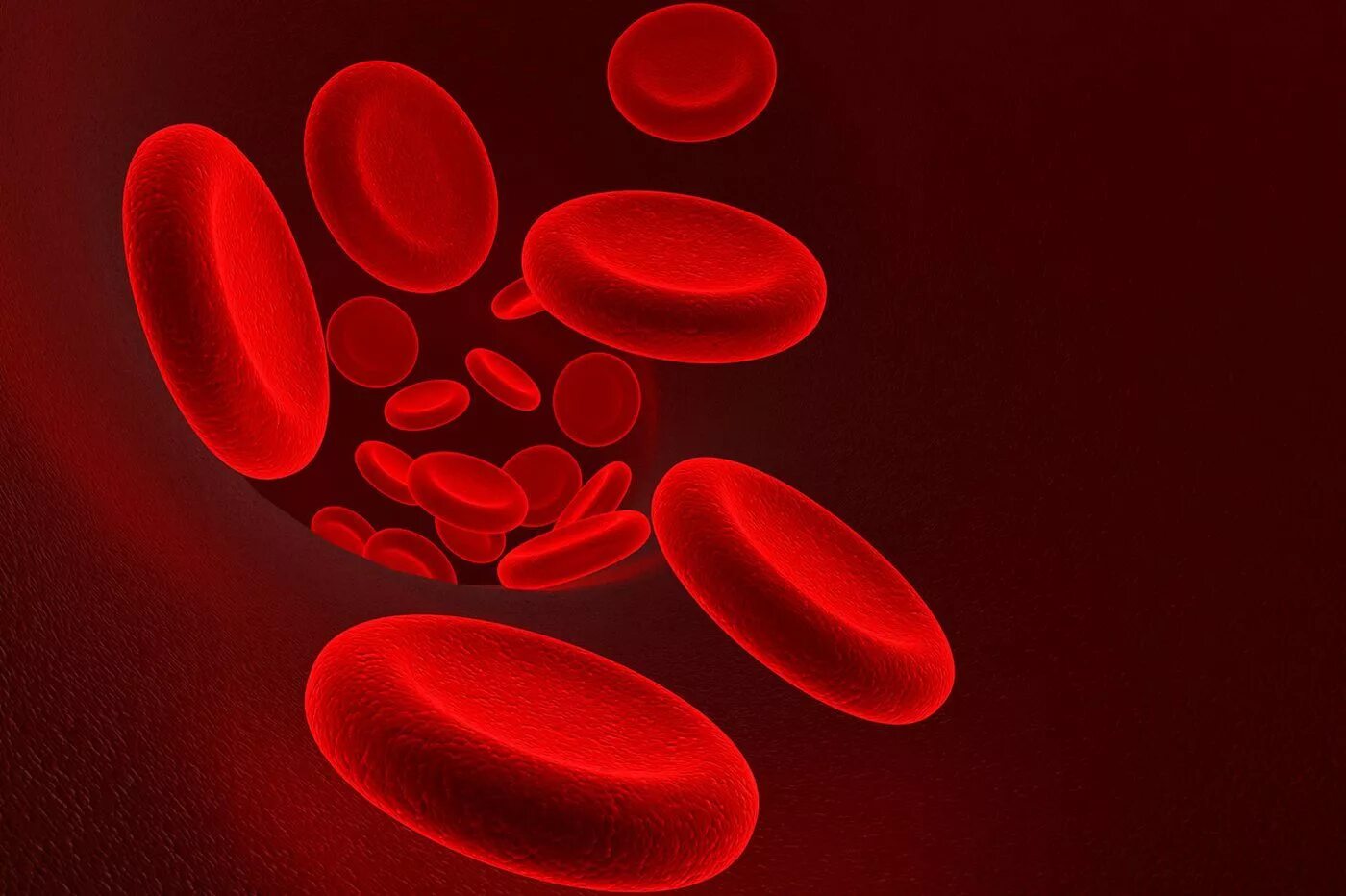 Картина периферической крови при гемолитической анемии. Уменьшение содержания эритроцитов в крови называется. Дефицит эритроцитов. Эритроцитарный дефицит. Железодефицитная анемия картина крови.