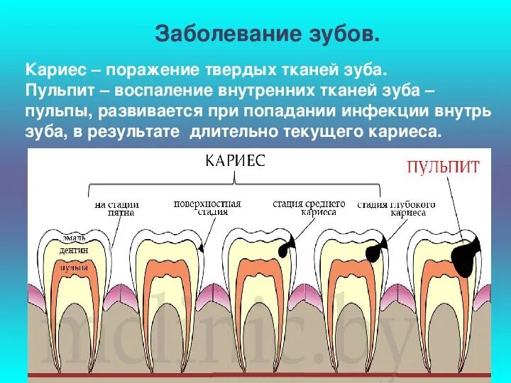 Почему зубы отличаются между собой у разных. Строение зуба кариес зуба. Пришеечный кариес фронтальных зубов. Кариес на переднем зубе сбоку.