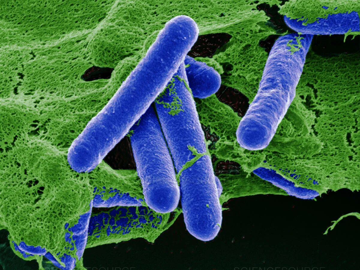 Признаки гнилостных бактерий