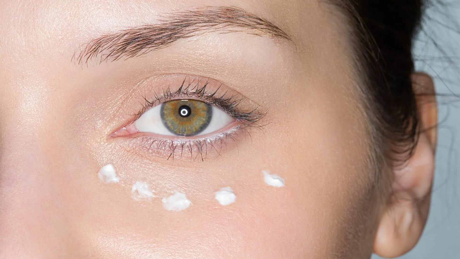 Зернистая кожа под глазами. Пигментация вокруг глаз. Пигментация вокруг глаз. Мелкие точки под глазами. Гиперпигментация кожи век.