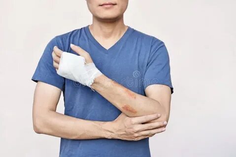 Wound man