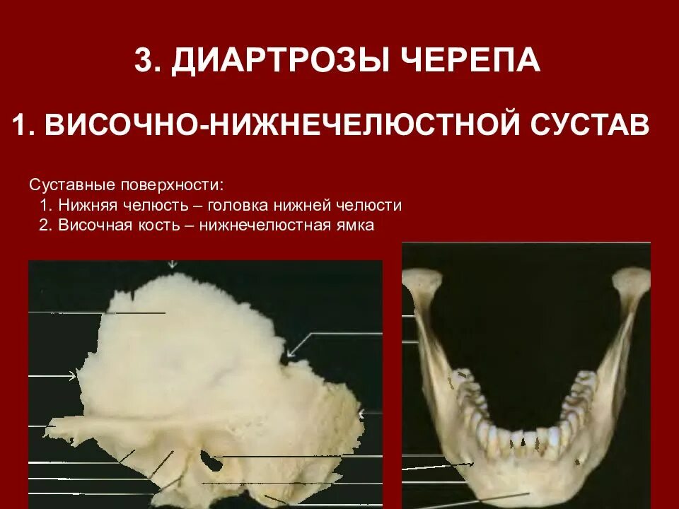 Анатомия сустава ВНЧС. Кости черепа височно-нижнечелюстной сустав. Нижнечелюстной сустав головка нижней челюсти. Череп анатомия нижнечелюстной сустав. Нижняя челюсть с другими костями черепа