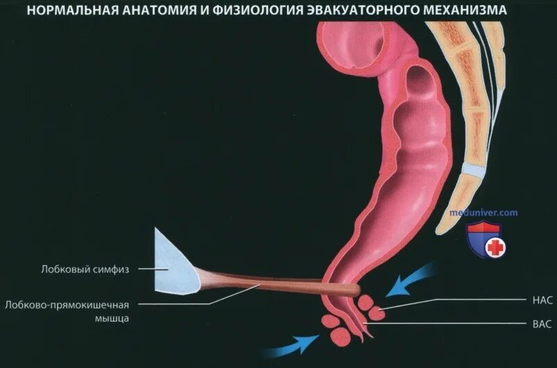 Https meduniver com medical book. Гидронефроз локальный медунивер. Гемитириоидэктомия медунивер. Грыжа Бохдалека рентген медунивер. Fecal Incontinence and Fistulas.