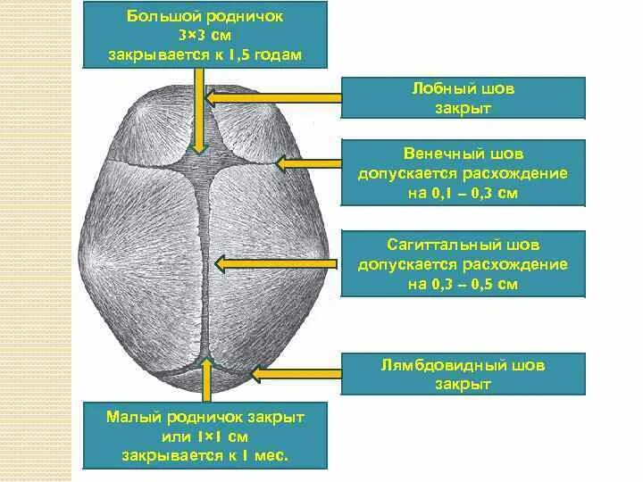 Родничку 1 3 на 1 3. Размеры швов и родничков новорожденного. Характеристика большого родничка. Сроки закрытия швов и родничков. Большой и малый Родничок.