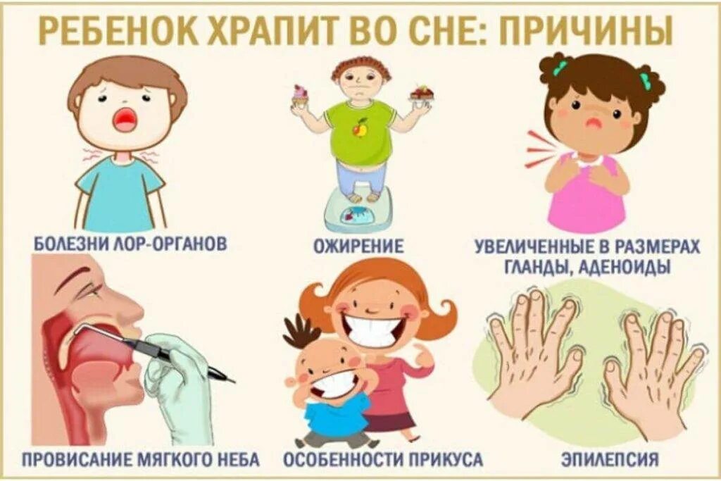 Храпит сопли. Ребёнок храпит во сне причины. детский храп причины. причины храпа у ребенка 2 года.