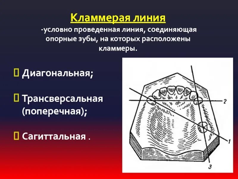 Линия а располагается. Сагитальнвя класммерная линия. линия соединяющая опорные зубы на которых располагаются кламмеры. сагиттальное расположение кламмерной линии. трансверзальное расположение кламмерной линии.