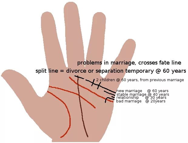 Коррекционная хиромантия линия брака. Линия брака островом. Линия брака. Две линии брака на руке. Линия брака островом.