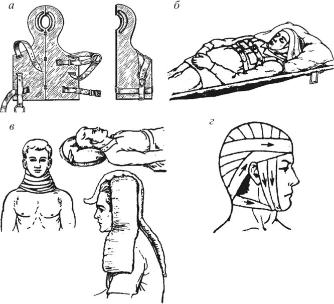 Шина при травме головы. Транспортная иммобилизация ватно марлевый круг. Транспортная иммобилизация при травматических повреждениях головы. Иммобилизация при переломе головы. Шина Еланского для иммобилизации головы.