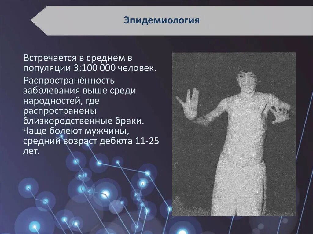 Вильсона Коновалова церулоплазмин. Гепатоцеребральная дистрофия (болезнь Вильсона). Вильсона Коновалова неврология. Вильсона Коновалова клинические рекомендации. Синдром вильсона коновалова что это такое простыми