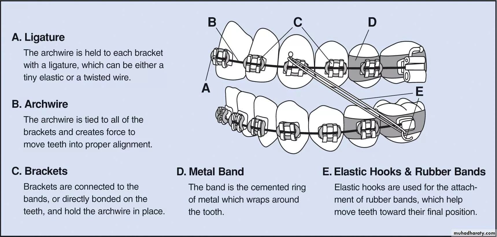 Bracket sequence