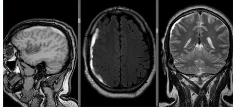 Анамның керемет бөксесі