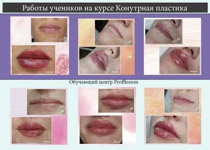 Через сколько дней делать массаж губ