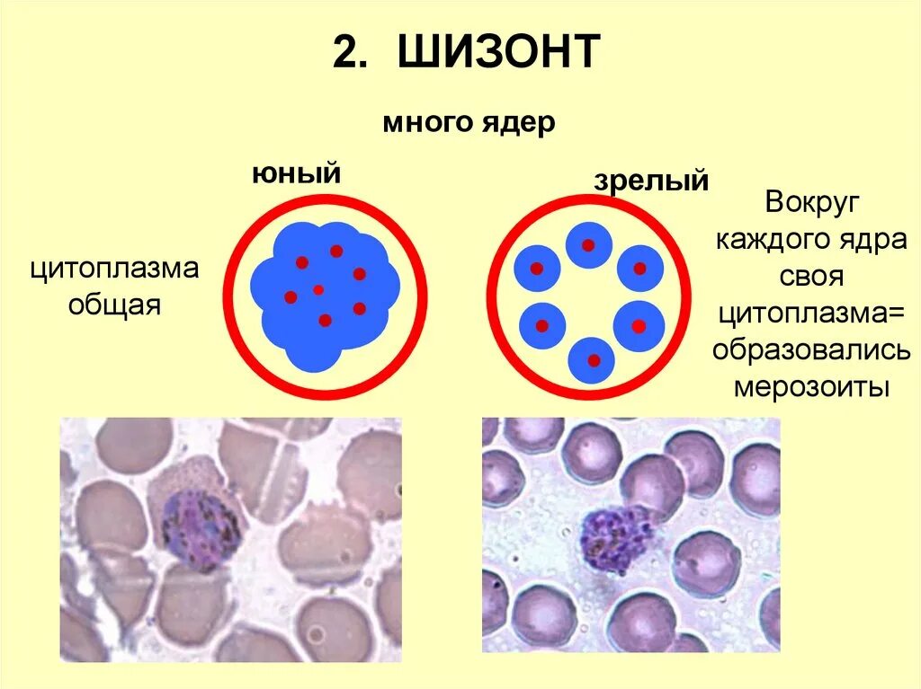 Малярия шизогония. Шизонт малярийного плазмодия. Шизонт малярийного плазмодия строение. Зрелый шизонт малярийного плазмодия. Шизонт это