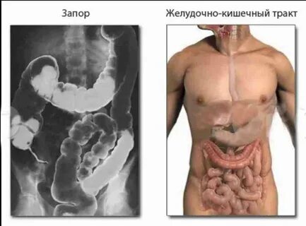 Кишечник отдает в почку