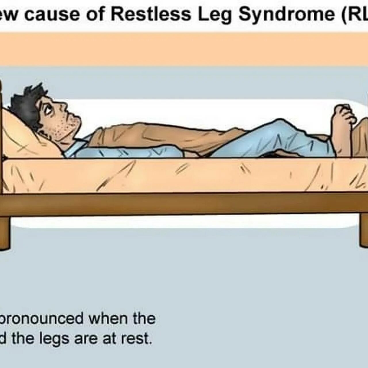 Почему не двигается нога. Синдром беспокойных ног. Дёрганье ног при засыпании.