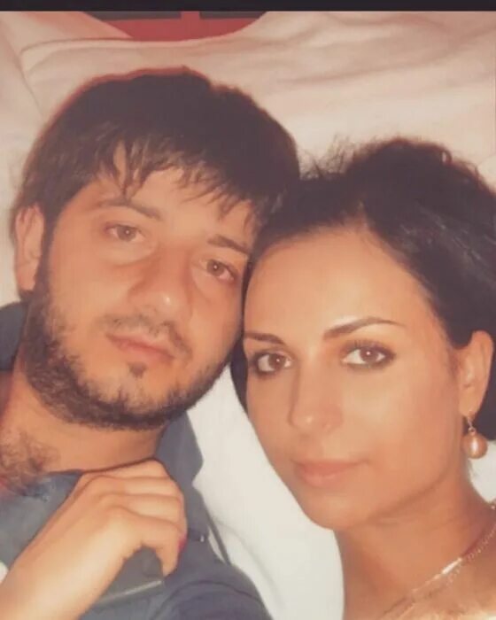Галустян до и после пластики Михаил Галустян: "Лучший подарок мне сделала жена." 7Дней.ру