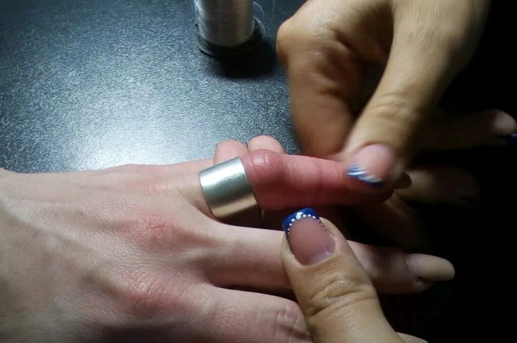 Как снять кольцо с отекшего пальца. Способы снятия кольца с опухшего пальца. Как снять кольцо с опухшего пальца видео