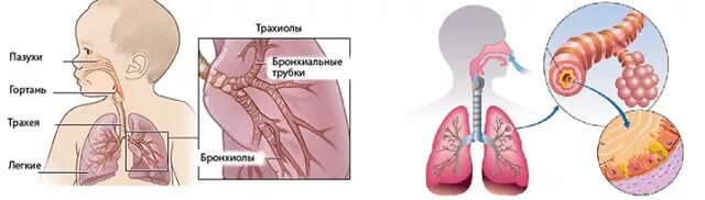 Ребенок инфицирован туберкулезом. Проявление туберкулеза у детей. Туберкулёз симптомы у детей 3 года. Признаки детского туберкулеза. Признаки туберкулёза у детей.