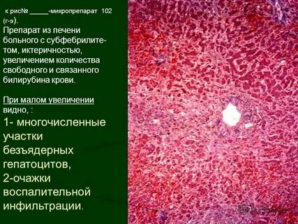 Абсцесс печени причины возникновения