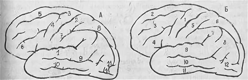 Борозды и извилины коры больших полушарий. Предцентральная борозда. Рисунок извилин и борозд сглажен. Борозды извилины лотераль латеральной поверхности. Извилины брюс