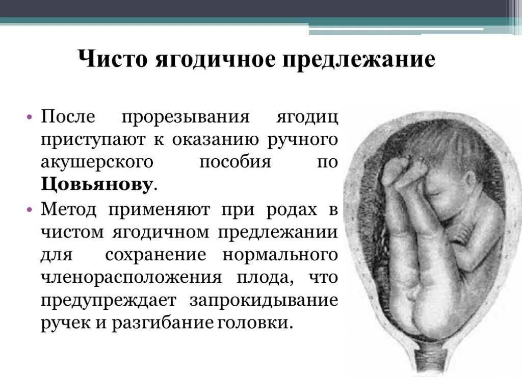 32 недели схватки. Головное предлежание плода на 20 неделе. Чисто ягодичное предлежание плода роды. Головное предлежание плода на 34 неделе беременности. Головное предлежание плода на 32 неделе.