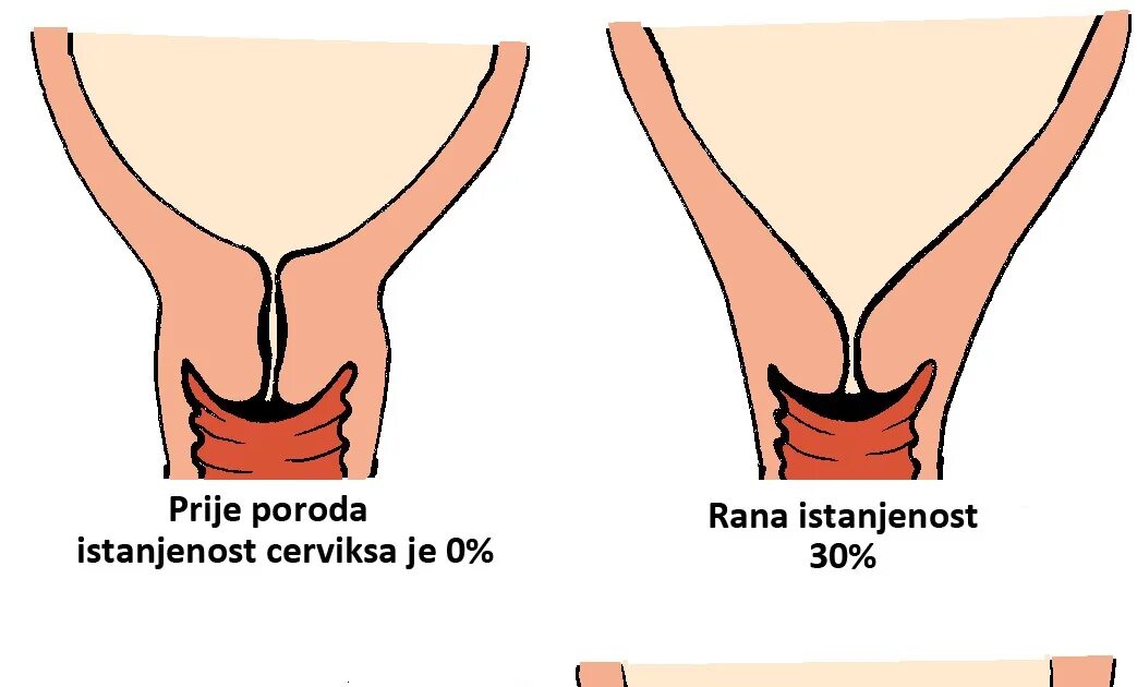 17 Obgyn ideas ob nursing, midwifery, nursing students