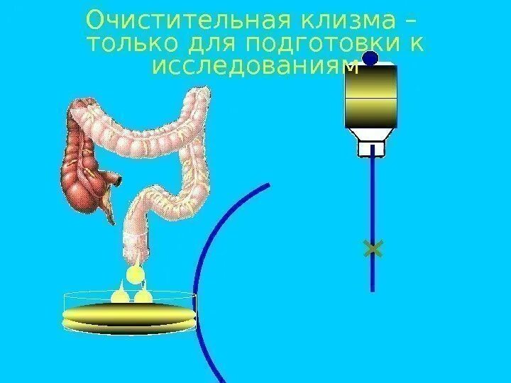 Время опорожнения кишечника. Подготовка к сифонной клизме. Сифонная клизма оснащение. Очистительная клизма кишечная непроходимость. Сифонная клизма алгоритм.