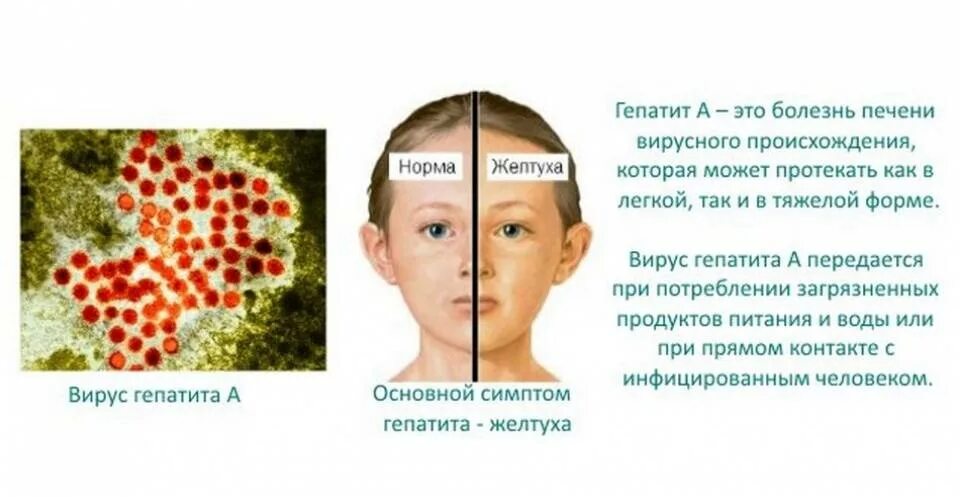 Болезнь лечится или нет. Болезнь вирусный гепатит. гепатит а болезнь боткина.