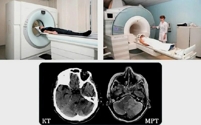 Сколько минут мрт. Кт томограмма головного мозга. Магнитно резонансные томограммы головного мозга. Мультиспиральная магнитно-резонансная томография. Компьютерная томография кт головного мозга.