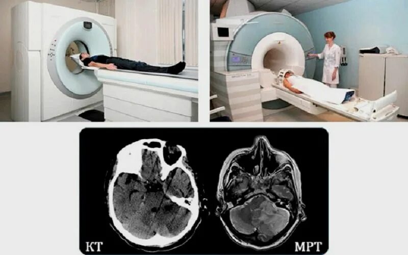 Можно ли кт. Кт мрт томограммы. Мультиспиральная кт головы. Кт (МСКТ) головного мозга. Рентген МСКТ УЗИ.