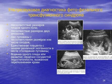 Синдром селективной задержки