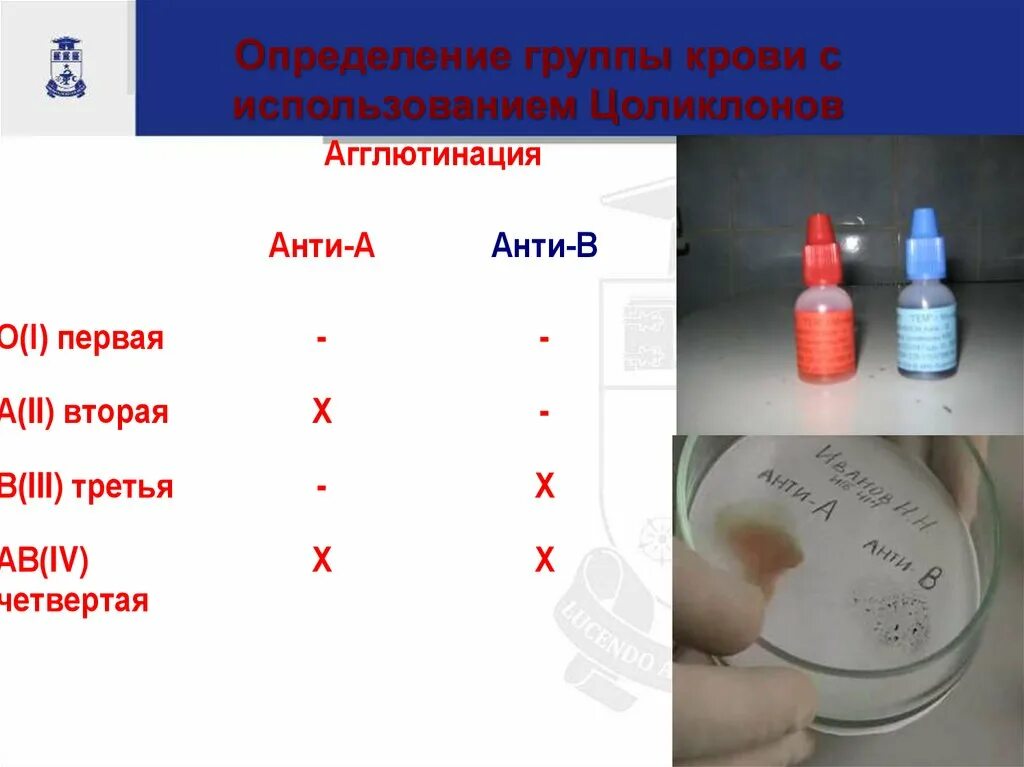 Группа крови с помощью цоликлонов. Определение группы крови. Цоликлоны для определения группы. Определение группы крови и резус фактора. Определение группы крови цоликлонами.