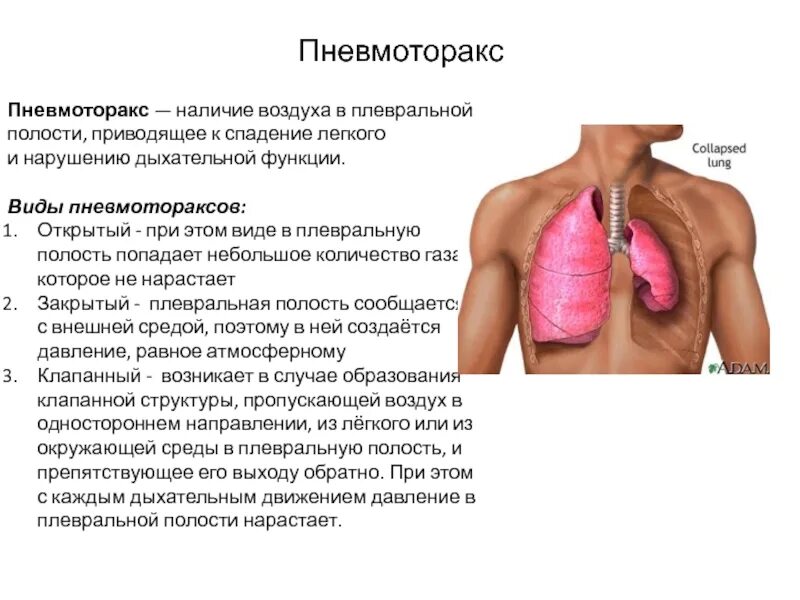 Дыхательная при пневмосклерозе