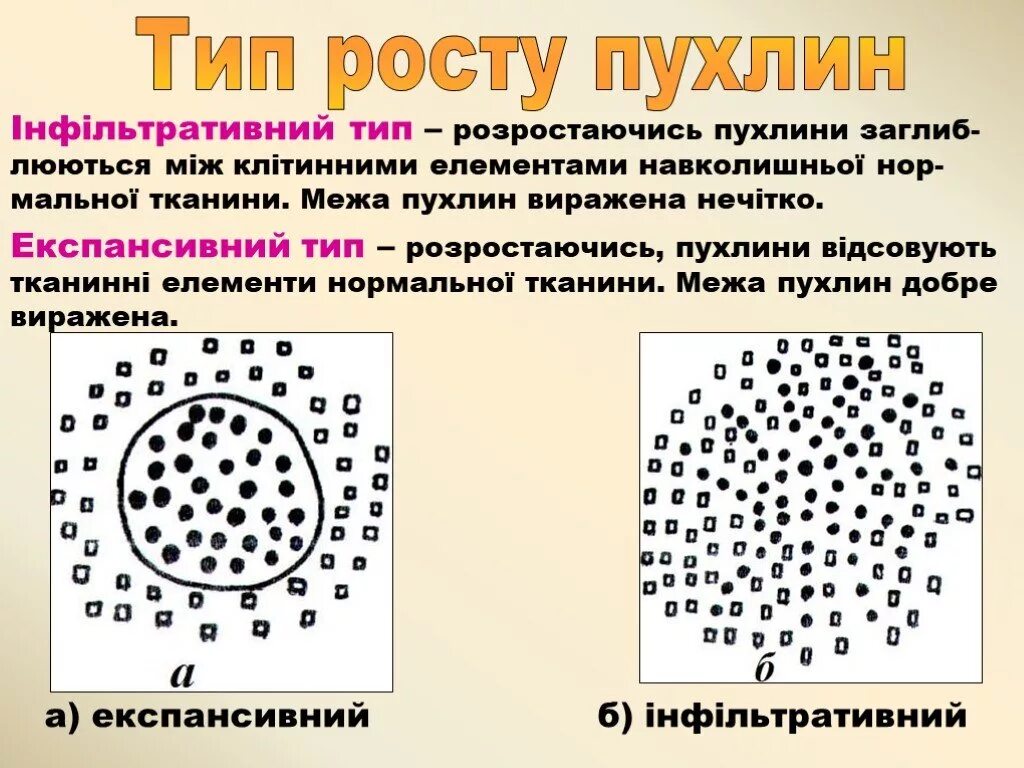 Экспансивный рост это. Типы роста опухолей. Виды опухолевого роста схема. Виды опухолевого роста рисунки. Инвазивный рост опухоли рисунок.