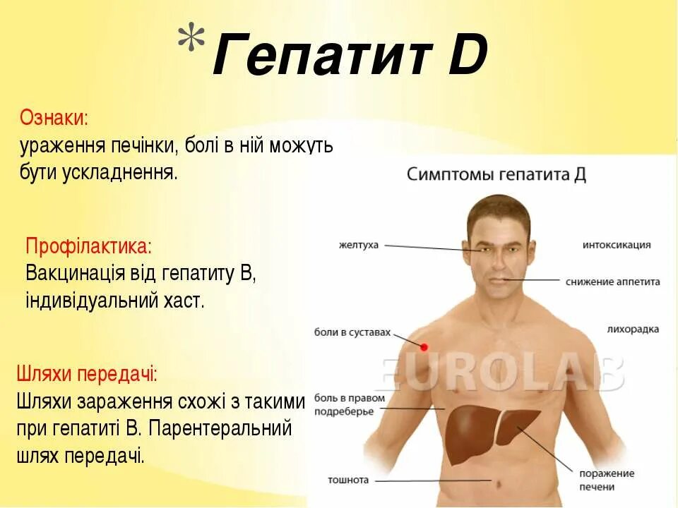 Начальные симптомы гепатита.