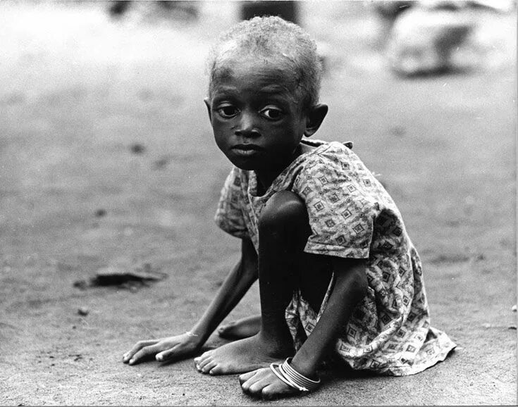 Голодающие дети Африки худые. Кевин Картер фотограф Пулитцеровская премия.