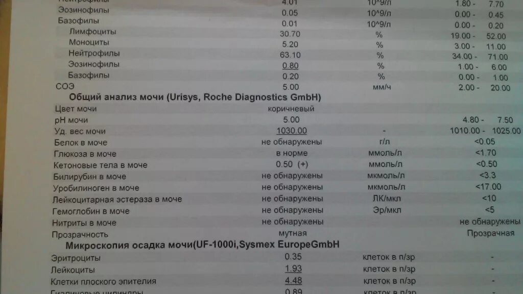 Что значит лейкоциты качественно в моче. Лейкоциты в моче 500. Анализ мочи лейкоциты 500. Лейкоциты 500 мкл в моче. Лейкоциты в моче в мкл.