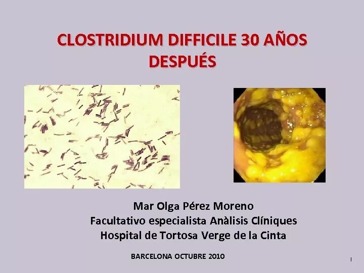 Клостридия диффициле Clostridium. Clostridium difficile микробиология. Эпидемиология клостридии диффициле. Клостридия диффициле микробиология. Clostridium difficile что это