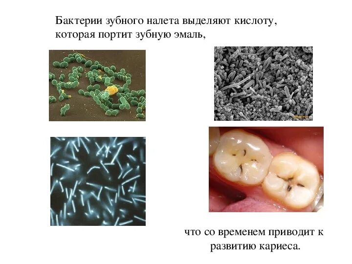 Зубной налет под микроскопом Налет зуба под микроскопом YouTube
