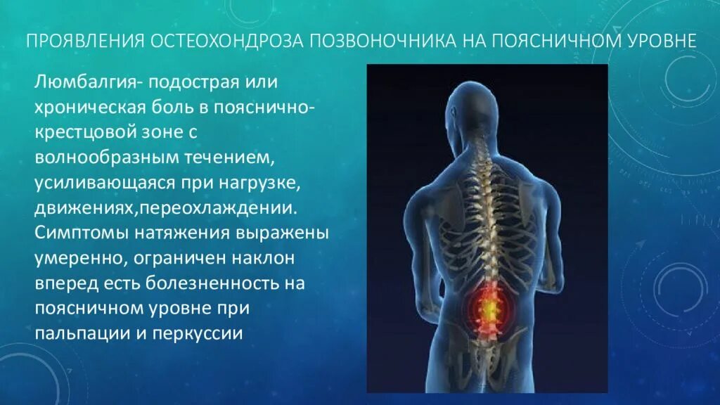 Симптомы поясничного крестцового отдела позвоночника. Проявление остеохондроза позвоночника. Болезни при остеохондрозе. Презентация на тему остеохондроз. Клинические проявления остеохондроза.