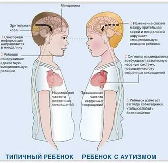 Ребенок рас что это значит
